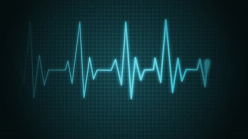 Medical ECG Heartbeat Monitor Waveform Loop
