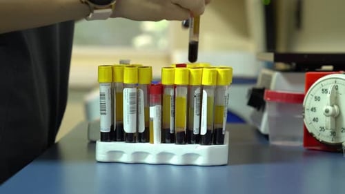 Medical Worker Places Blood Tubes in Rack