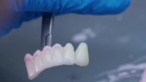 Applying Coating to a Dental Bridge