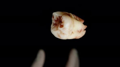 Extracted Molar Tooth Held by Gloved Fingers
