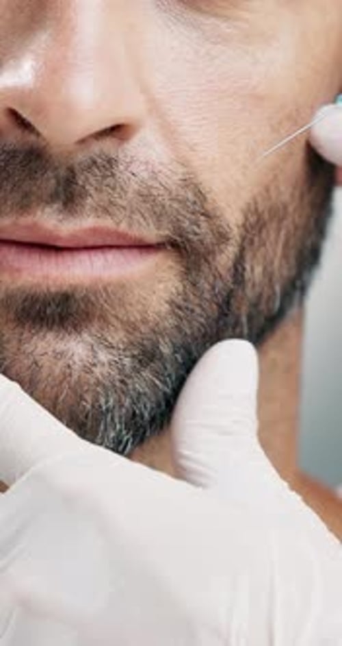 Injection, collagen and mouth with man and hand for dermal filler, anti aging
