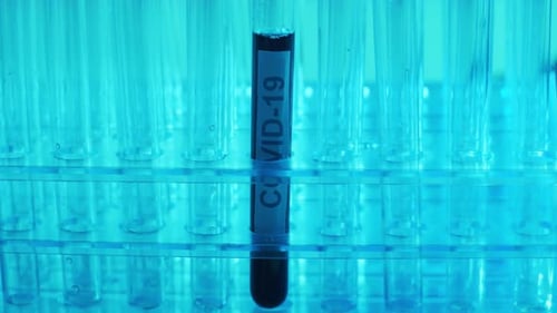 Laboratory Tubes with Blood and Virus Closeup of Scientific Lab in Hospital Epidemic Disease