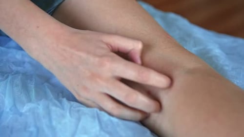 Child Scratch Body Sensitive Itchy Skin Bodily Rash Teen Allergy Closeup Teenage Girl Scratches