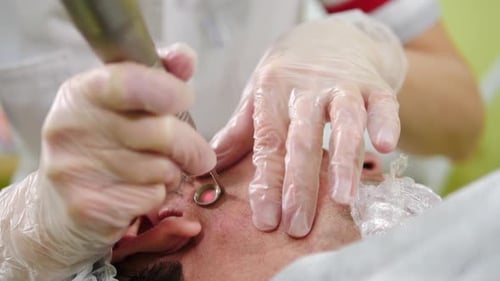 Laser Skin Treatment for Man in Clinic