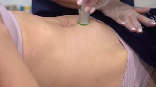 Alexandrite Laser in Aesthetic Medicine Woman on Laser Hair Removal Treatments Belly Area Beautician