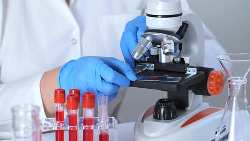 Microscope Blood Analysis by Healthcare Professional