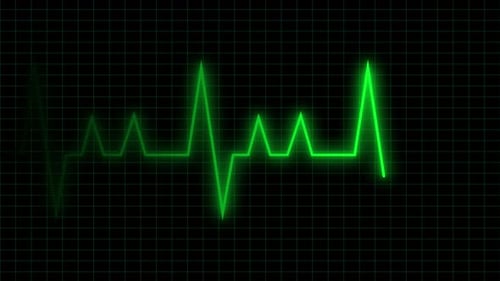 Medical ECG Heart Rate Monitor Display