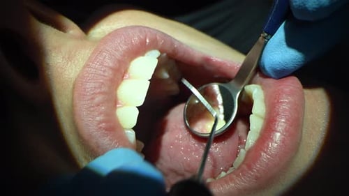 Dental Care Extreme Close Up Macro Video Dentist Treat Patient Teeth Orthodontist Works with