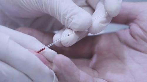 Doctor Hand Taking Blood Sample for Medical Test. Close Up of Blood