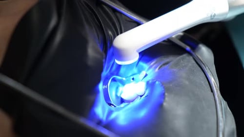 Close Up Dental Treatment With Blue Light