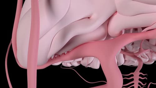 Cerebral Arteries Blood Flow Blocked By A Clot
