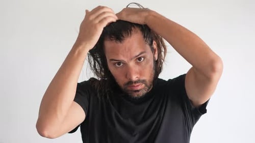 Thinning hair, latino man checking his hair with receding hairline and baldness.