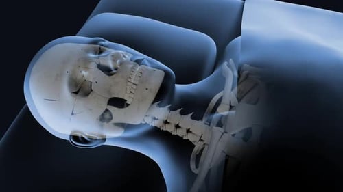 3D Medical Head Scan Revealing Skull and Teeth Anatomy
