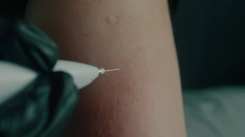 Close Up of Medical Treatment Being Performed