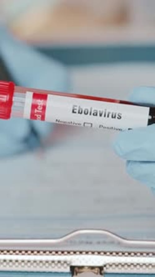 Ebolavirus Blood Test Sample Close Up