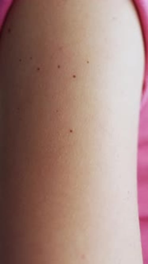 Bandage on arm after shot