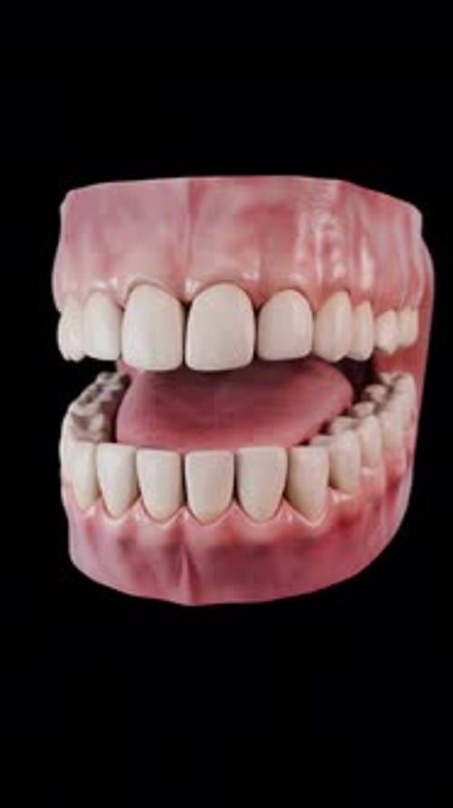 Animated 3D Human Teeth and Gums with Disease Progression