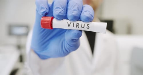 Virus Sample Displayed in Laboratory Setting