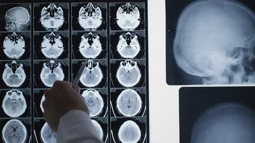 Röntgenanalyse in der Radiologie