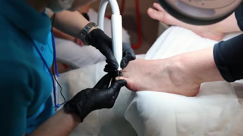 Foot Receiving Treatment with Electric File
