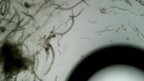 Microscopic Life Forms Moving in Fluid Under Magnification