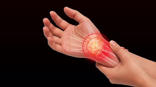 3D Animated Human hand having wrist Pain Highlight