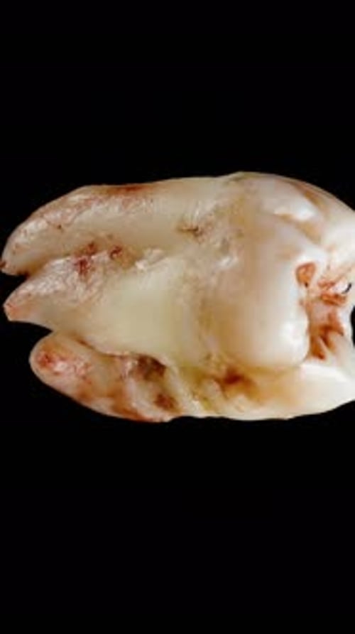 Vertical video. Top view of a extracted tooth in blood cyclically rotating on an isolated black