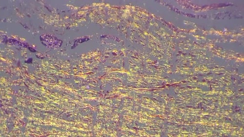 Sweat Glands on Human Skin Filmed Under Microscope 40x with Cross Light