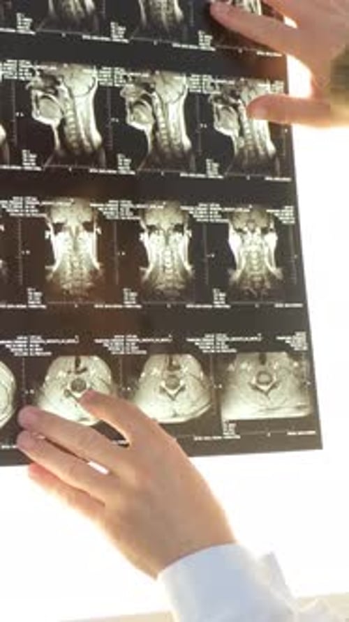 A Vertebrologist Examines an Xray Image of a Female Patient's Spine in the Hospital Vertical Video