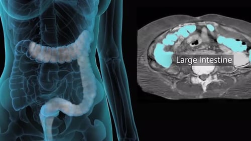 Human digestive system with highlighted large intestine