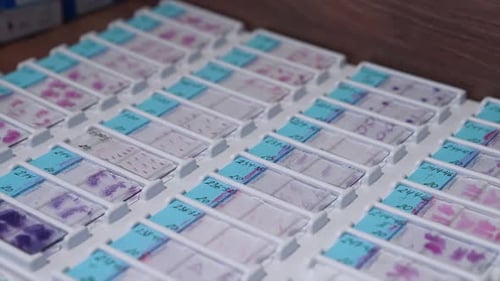 Organized Medical Glass Slides for Research