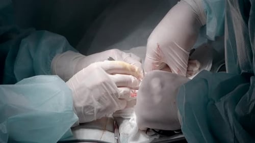 Surgeons Perform Operation in Operating Room Close Up