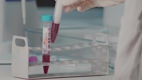 Blood Sample Tubes Placed in Rack Close Up