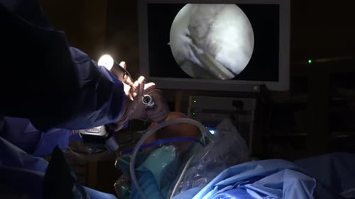 Anterior Cruciate Ligament Acl Reconstruction