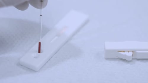 Blood Sample Drop to Analyzer. Closeup of Blood Test Process. Close Up