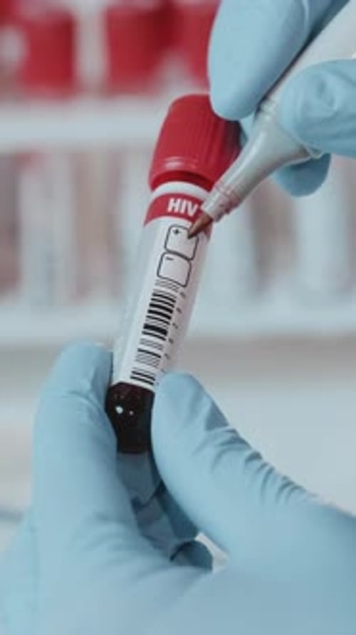 Test Tube Sample Marked HIV Positive