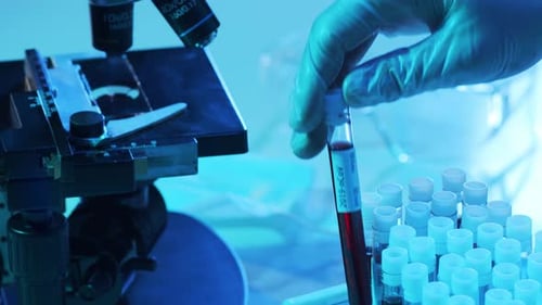 Laboratory Tubes with Blood and Virus Closeup of Scientific Lab in Hospital Epidemic Disease