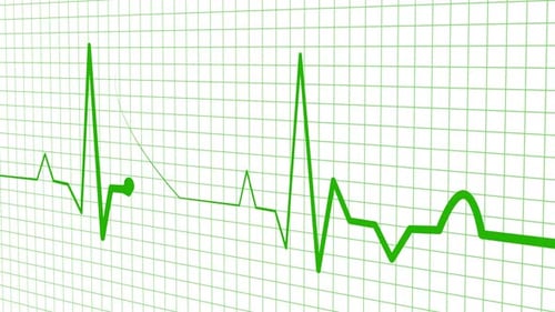 Heartbeat-Monitor-Display-Animation, eine digitale Darstellung einer Herzschlagmonitor-Anzeige