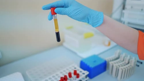 Doctor Holds Vial of Blood in Medical Laboratory