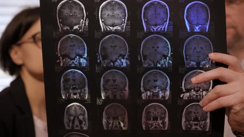 Doctor Examining Brain Scan with Colleague in Hospital
