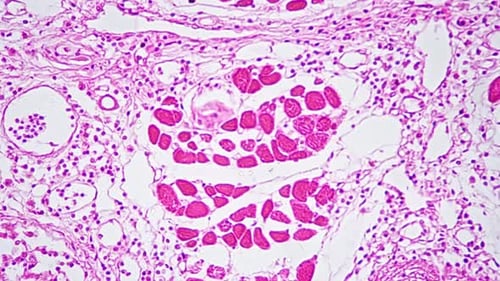 Longitudinal Section of Human Lung Filmed Under Microscope 400x Against Bright Field