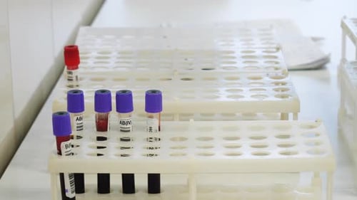 Placing Blood Samples in Laboratory Rack