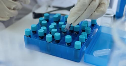 Test tube, blood or hands in clinic for research, biology or dna investigation for pharmaceutical