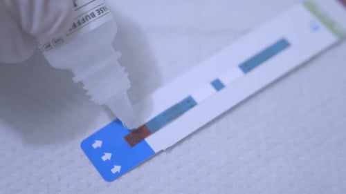 Close up hiv blood test reagent dropping on test strip in medical lab