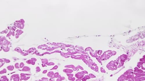 Large Vein Pattern in Section Filmed Under Microscope 200x on White Background