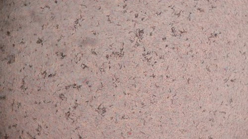 Fresh blood and insulin on microscope view. Blood smear under microscope present insulin