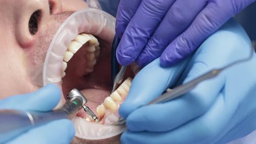 Dentist Performing Procedure on Man's Teeth