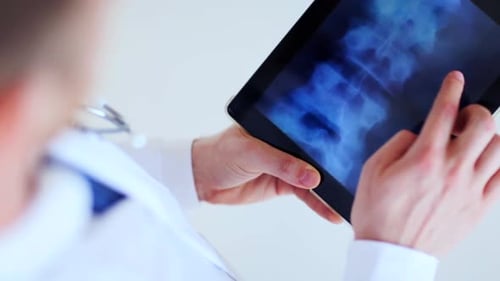 Doctor Examining X-ray on Tablet in Hospital
