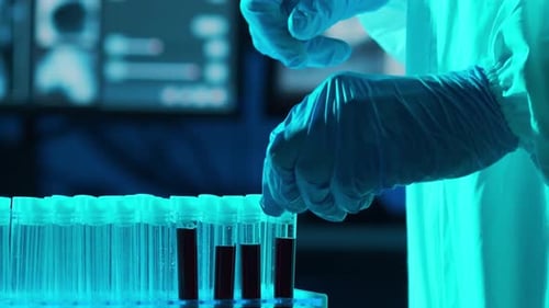 Blood Samples in Vials, Medical Lab, Close Up