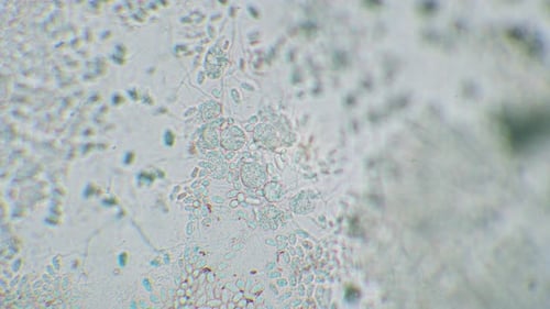 Slime mold amoebas